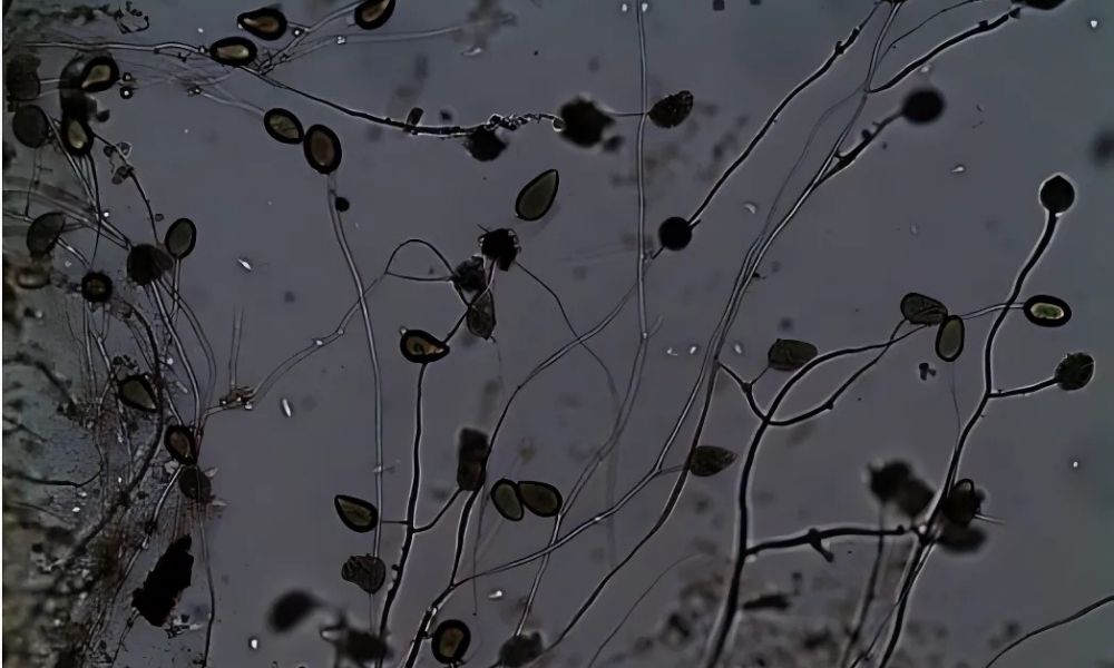 Nấm Phytophthora gây bệnh nứt thân xì mủ sầu riêng Nấm Phytophthora gây bệnh nứt thân xì mủ sầu riêng