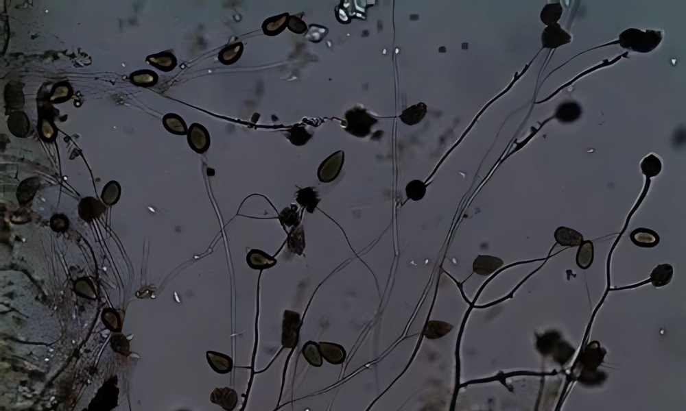 nấm Phytophthora