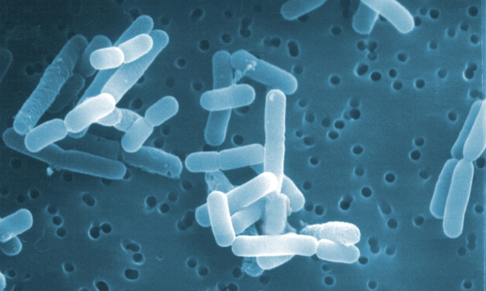 Lactobacillus (vi khuẩn lactic)