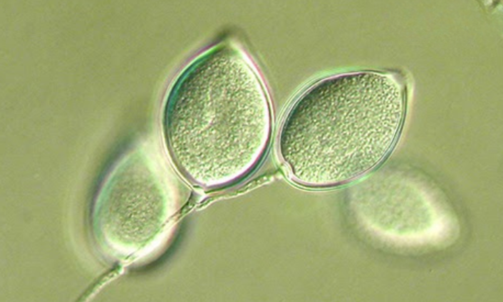 Nấm Phytophthora palmivora - nguyên nhân gây thối trái sầu riêng