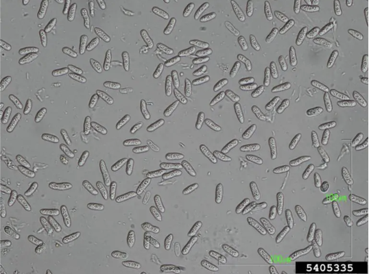 Nấm Colletotrichum gây nên bệnh thán thư
